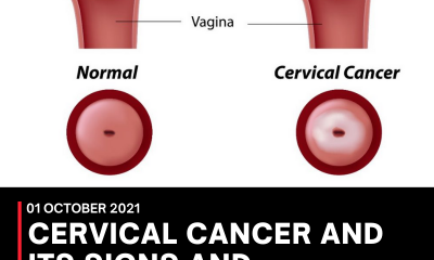 CERVICAL CANCER AND ITS SIGNS AND SYMPTOMS IN WOMEN